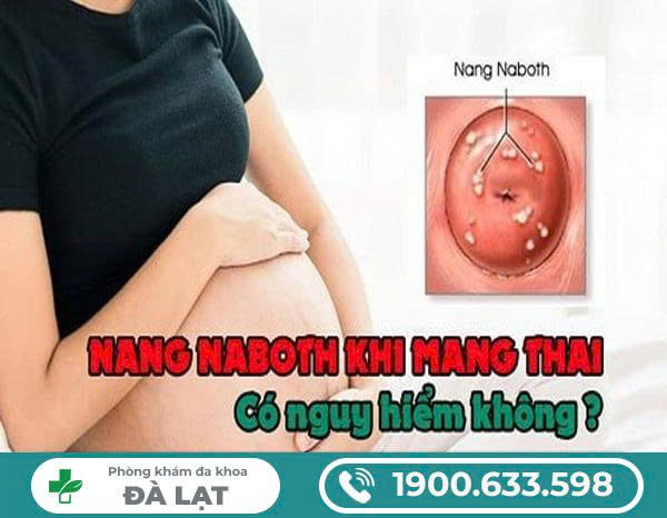 Hình ảnh minh họa